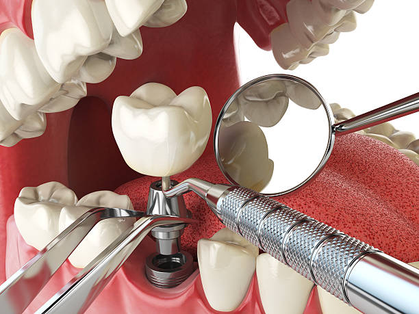 Best Emergency Cosmetic Dentistry (e.g., broken veneers) in Rancho Alegre, TX